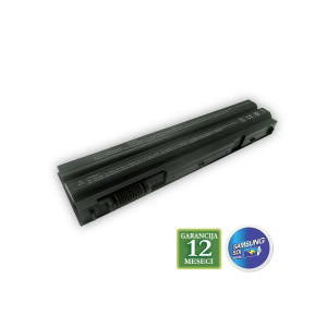 b4e3d6610efd950d842d1ca8d0f67006 Koja je najbolja zastita za telefon u 2022